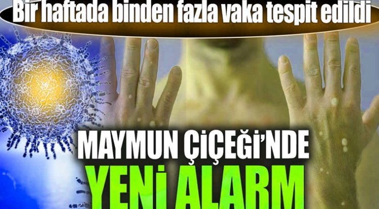 M Çiceği Virüsü Hızla Yayılıyor